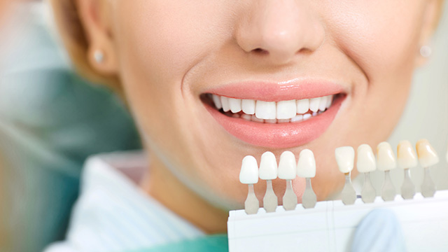 Woman with wide smile showcasing teeth, likely a dental professional, set against a background of dental equipment and tools.