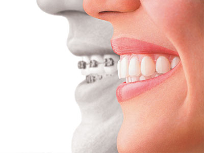 The image shows a split-screen comparison of a person s face with their teeth and gums clearly visible on both sides, emphasizing dental health and care.