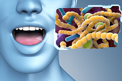 The image is a digital graphic with a split composition  on the left, there s an illustration of a human face with an open mouth, and on the right side, there s a microscopic view of bacteria and viruses, suggesting a connection between oral health and microorganisms.