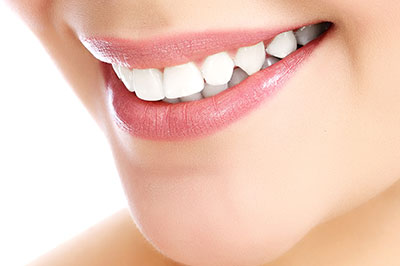 The image shows a close-up of a person s face with a focus on their smile, featuring bright white teeth and pink lips.