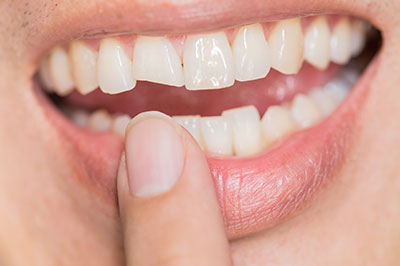 An individual s hand holding a finger over an open mouth showing teeth, with a focus on dental hygiene, possibly for an advertisement or educational purpose.