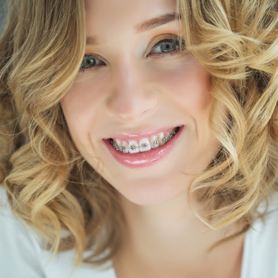 The image shows a woman with braces smiling at the camera.