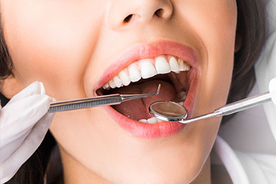 Woman with open mouth receiving dental care, surrounded by dental tools and equipment.