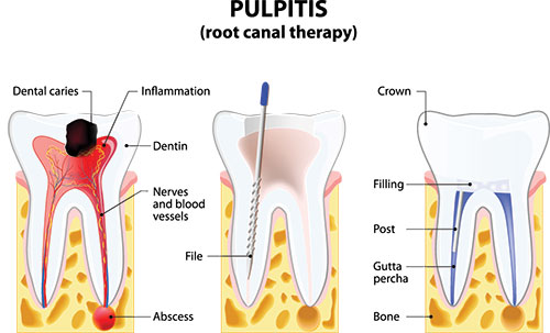 The image displays a detailed illustration of a human tooth with a focus on its structure, including the crown, dentin, enamel, root canal, nerve, and surrounding tissues, along with annotations explaining various parts.